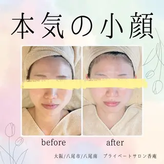 小顔・たるみケア✨ フェイシャル&ボディのエステ・リラクイメージ