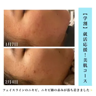 Bellesthe （ベルエステ）のエステ・リラクイメージ