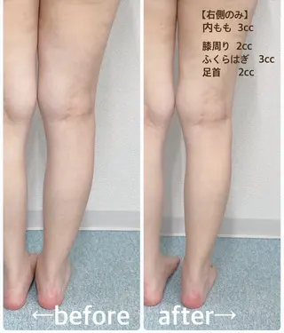 小顔痩身HALO 二宮早織のエステ・リラクイメージ