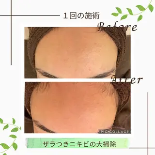 ニキビ改善サロン 縁樹 enju所属・ニキビ専門サロン縁樹 鈴木真樹のエステ・リラクイメージ