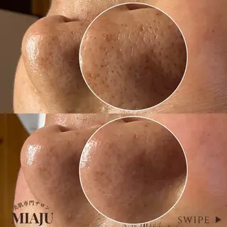 美肌専門サロン MIAJUのエステ・リラクイメージ