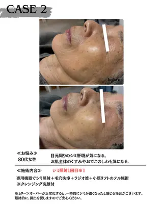 【医療提携サロン】 【シミケア専門】のエステ・リラクイメージ