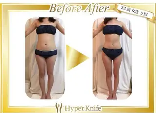 ワックス脱毛 ♡AYO♡のエステ・リラクイメージ