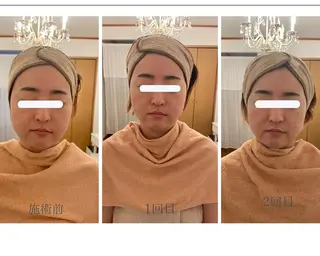 MA CHÉRIE所属・体質別痩身&小顔 MA CHÉRIEのエステ・リラクイメージ