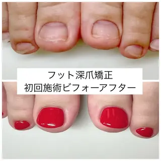 ネイル ネイルサロン アリュームのネイルデザイン