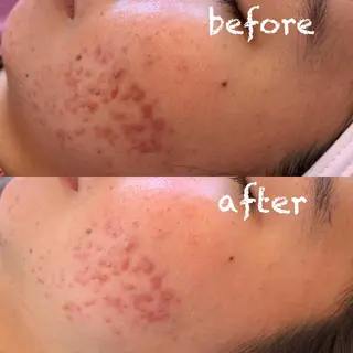 美肌蘇生カウンセラー 横山りえのエステ・リラクイメージ