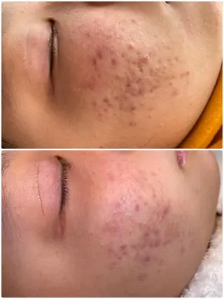 Knine 心斎橋店のエステ・リラクイメージ