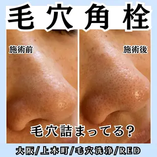 毛穴レス ハーブ＆ ワックス脱毛×光脱毛のエステ・リラクイメージ