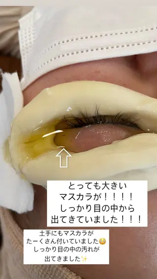Rene 慢性疲労ケアサロンのエステ・リラクイメージ