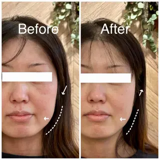 小顔サロン Lehua-ﾚﾌｱ-のエステ・リラクイメージ