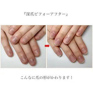 ネイル ネイルサロン アリュームのネイルデザイン