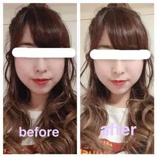 美容鍼灸サロン YOSHINOのエステ・リラクイメージ