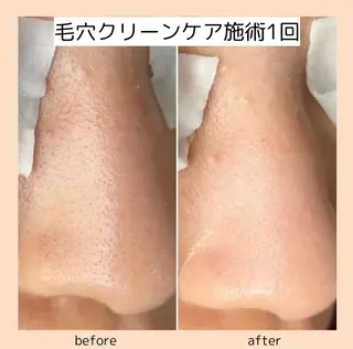 three ﾜﾀﾅﾍﾞのエステ・リラクイメージ