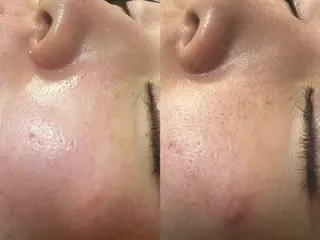 池袋脱毛 さとうのエステ・リラクイメージ