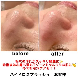 ネイル・エステサロン UILANIのネイルデザイン