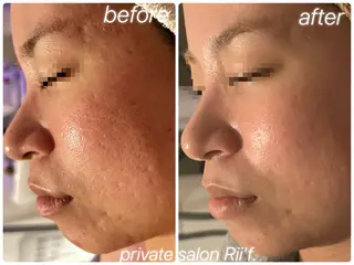 private salon Rii'f.所属・private sa lon Rii'f.のエステ・リラクイメージ