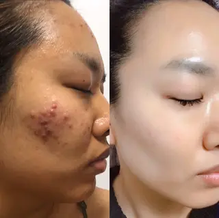 メンズ 朝重い人専用 肩甲骨調整のエステ・リラクイメージ