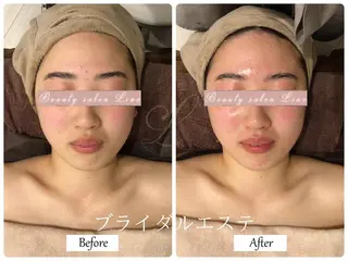 ブライダルサロン ｜Lino【堀江】のエステ・リラクイメージ