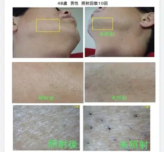 セルフ脱毛 One Salonのエステ・リラクイメージ