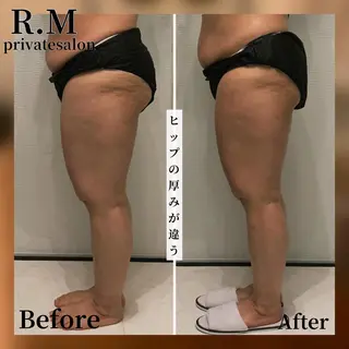 プライベートサロン R.Mのエステ・リラクイメージ