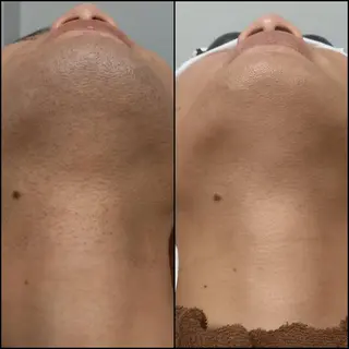 Iryアイリー所属・Iry アイリーのエステ・リラクイメージ