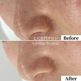 毛穴ケア専門サロン アメリオボーテのその他イメージ