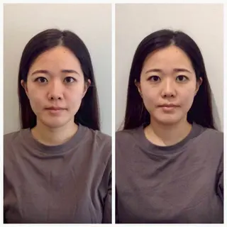 美容整体プラスフィール、錦糸町店所属・錦糸町美容整体 プラスフィール 小山のエステ・リラクイメージ