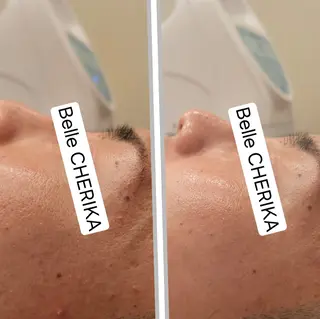 ベル チェリカ 三城のエステ・リラクイメージ