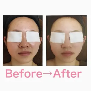 【二子玉川】 ビューティコアのエステ・リラクイメージ