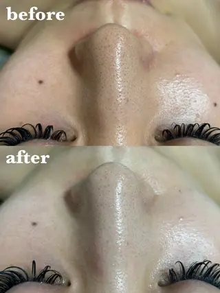 肌質改善＆脱毛 【M Mondo】のエステ・リラクイメージ