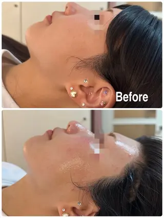 NICORI所属・NICORI大宮 (看護師)塩野飛のエステ・リラクイメージ