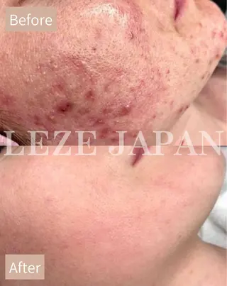 Lilyboo 池袋のエステ・リラクイメージ