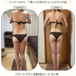 《本気痩せ×疲労改善 》  BILOOPのエステ・リラクイメージ