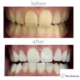 船橋セルフホワイトニング【NAホワイトニング船橋店】所属・セルフホワイトニング NA船橋店のその他イメージ