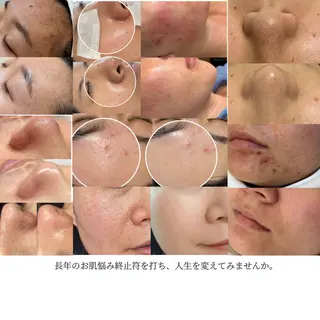 LUMINA ESTHのエステ・リラクイメージ