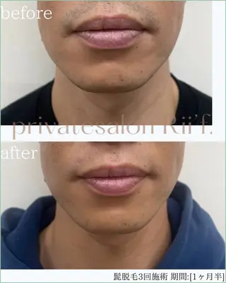 private salon Rii'f.所属・private sa lon Rii'f.のエステ・リラクイメージ