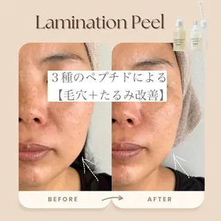 hue.所属・hue. YUKAのエステ・リラクイメージ