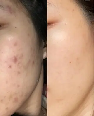 aliaハーブ水光店 エステティシャン募集のエステ・リラクイメージ