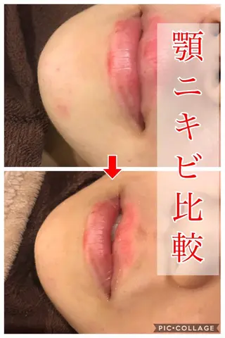 ロング カラー パーマ ヘアアレンジ メンズ キッズ ネイル マツエク・マツパ 金の糸脱毛 産毛ケア専門のエステ・リラクイメージ