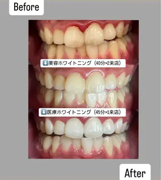 Kaula ホワイトニング🦷✨のエステ・リラクイメージ