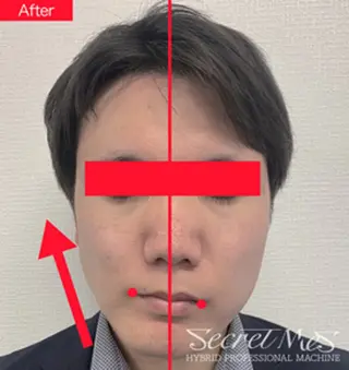 伊藤 正美のマツエク・マツパデザイン