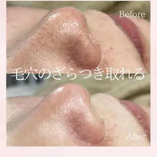 美肌脱毛&毛穴専門 Nico🐰ྀི♡のエステ・リラクイメージ