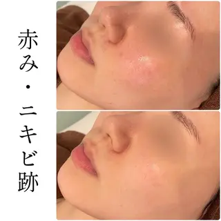 ハーブピーリング専門 BIOEL横浜のエステ・リラクイメージ