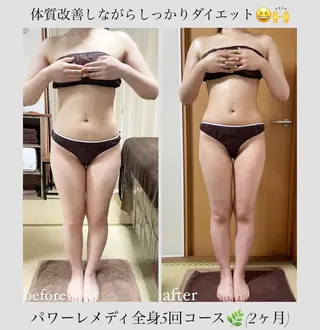 《本気痩せ×疲労改善 》  BILOOPのエステ・リラクイメージ
