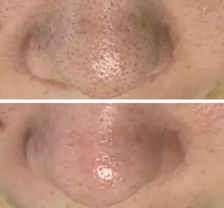 アトリエ ハルミナのネイルデザイン