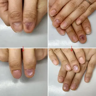 ネイル ネイルサロン アリュームのネイルデザイン