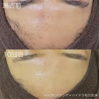 lulula ricoのエステ・リラクイメージ