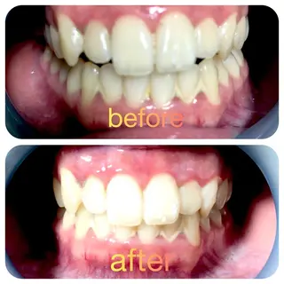 two nailのネイルデザイン