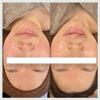 Florence  〜salon de nurse所属・Florence めぐみのエステ・リラクイメージ