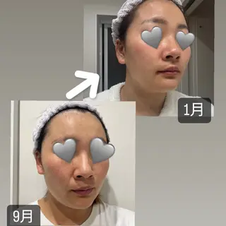 鳳北町 森田はるかのエステ・リラクイメージ